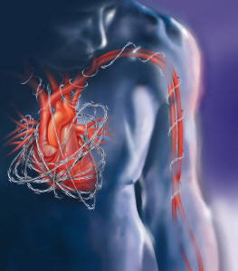 </p><p>从易命理论与中医理论方面讲，心脏病与脑血管病有紧密的关系。心脏衰弱，容易引起脑血管供血不足；高血压、心脏压力大又容易引起脑出血、溢血、血管破裂；脑血管淤塞、堵塞、壅塞，又容易引发心脏病等。</p><p>现代医学从心脏及脑血管病的显象方面分析，把心脏及脑血管病分为多种类型。如心脏病常见的有风湿性心脏病、冠心病、心肌梗塞、心肌炎、心血管病等，脑血管病又分脑血栓、脑出血、溢血等。</p><p>易命学与祖国医学从患病的根源分析，把心脏、脑血管病主要分三种类型：一、虚湿缺养型；二、躁热淤塞型；三、氧化不良型。各种类型的心脏、血管病，有时病症反映近似，然而其发病根源相差甚远，有时甚至截然相反。假如分不清根源，采用相同的治疗方法，势必造成危险。临床治疗中分清病之根源，非常重要。本文综合易、医学理论，就心脏、脑血管病的患病规律及防治方法作以下论述。</p>一、虚湿缺养型<p><strong>1、四柱特点</strong></p><p>地支水旺，天干见水克丁火，易患心脏病。年、月柱见金水旺，易并发脑血管病，脑溢血者较多。一般在水旺流年、或行火弱运患病。</p><p>例：</p>    坤造：癸丑、甲子、辛未、丁酉。癸亥年(83)死于心脏病。    乾造：丁丑、壬子、辛巳、己亥。壬申年(92)发现心脏病，乙亥年死于心脏病。    坤造：癸巳、甲子、癸巳、癸亥。丁丑年(97)发现心脏病。    乾造：丁卯、壬子、辛亥、辛卯。壬申年(92)死于心脏病。    乾造：丁酉、丁亥、丁巳、甲辰。癸酉年(93)发现心脏病。    乾造：癸酉、癸亥、丁酉、癸卯。癸酉年(93)发现心脏病，患脑溢血。    乾造：己丑、乙亥、丁亥、乙巳。癸酉年(93)发现心脏病。    乾造：丁亥、癸丑、壬戍、癸卯。壬申年(92)、癸酉年(93)心脏病重。<p><strong>2、命理分析</strong></p><p>丁火在体主心脏、血、热、气。亥、子、壬、癸在体主肾、水、寒。体内水火既济，方能保证气、血、水的运化平衡。丁火弱主心脏弱，丁火被水欺，主血质稀、血红素指数偏低，热量不足，气行缓慢、滞怠。脾胃寒湿，运化营养物质不良，供养不精，寒湿成份过重。丁火弱、水旺，又主性情多固执、守旧，多愁善感，身消瘦、懒动、气衰乏力。患病期间，颧部常见湿红，鬓至眼角部见青气。胸闷，缺少气力，恶寒、喜静。</p><p><strong>3、中医分析</strong></p><p>有虚湿缺养型心脏、脑血管病隐患的人，脉多沉细、涩、弱、弦、微，脉数常<65次/分。患病期间，脉数不匀，忽多忽少，常伴有结脉。恶寒、盗汗，少量活动，心慌不安。人消瘦、烦闷、气虚力乏。主要病因在身湿寒、脾胃湿寒，运化营养物质不良。三焦运化中，水湿过多，血质稀，心脏各组织供养不足，营养不良，心力衰弱，长期负担重。由于心脏压力弱，使周身供血不足，脑部亏气、血，脑血管因长期缺少营养，造成脆弱，以致当忽然出现高血压时，造成溢血，严重时出现中风病瘫。身虚湿者，患癌症及糖尿病的极少，死于心脏病、脑溢血者最多。</p><p><strong>4、西医分析</strong></p><p>有虚湿缺养型心脏、脑血管隐患的人，日常血压都偏低，血质偏稀，血清胆固醇指数偏低、血红素指数偏低、蛋白成份不良。患病期间血压忽高忽低，血压稳定性差。血压低属患病的原发基因，血压高是因心脏或脑血管病变、发生壅塞造成的，是突发性的。虚湿缺养型主要是机体组织吸收、消化营养成份不良造成的，其中主要是吸收寒湿、冷气过多的原因。该病患者，心、脑血管出血、溢血者较多。</p><p><strong>5、防治</strong></p><p>防治原则，要以增强热量、增大营养为主；治疗要以补血气、增大热量，养脾胃，壮身养心为主。</p><p><strong>防：</strong></p><p>有虚湿缺养型心脏、脑血管病隐患的，多数有偏食、挑食的不良习惯。在饮食方面要注重多进热性食品，如羊肉、狗肉、小米、大枣、姜、赤小豆等。在住宿方面，要选择阳光充实、干燥的环境，室内布红光普照威风凛凛，要选八卦方位的离宫( )、巽宫( )，选择九星位的生气、天医之地。</p><p><strong>治：</strong></p><p>治疗原则：壮阳抑阴，增强脾胃的热量和运化功能，养心、养气血。</p><p>治疗虚湿缺养型脑血管病，除了心脏出现止息状态或脑血管溢血病状时，应采取西医注射和输液的救急治疗办法外，一般应采用中药治疗为主，西药为附的治疗办法。</p><p>常用中药有：酸枣仁、柏子仁、莲子心、远志(以上补心脏类)，红花、川芎、鸡血藤(以上活血药)，山药、熟地、人参、何首乌、当归、黄芪 (以上补气血类)，鸡内金、苍术、大枣、附子、肉桂(以上补脾胃热药)。</p><p>心脏弱、烦闷者，可重用补心脏类；血压升高次数频繁，可重用活血药；气衰、乏力，可重用补气血药；脾胃虚寒，可重用补脾胃热药。另外，可用柏子养心丸、桂附地黄丸附助治疗。免用丹参养心丸，因丹参属凉性。另外：可用偏方。</p><p><strong>方一：</strong>柏子仁21g、酸枣仁21g、莲子心21g、附子18g、肉桂18g、当归21g、大枣12粒、红花12g、姜片12g、川芎12g。</p><p>以上药泡米酒3斤，七天后可饮用，天天早晚各饮1-3盅。初饮时，心脏有短时间过速现象，常饮无防。饮量根据自身承受能力定，饮量一次不得超过3盅。适应男性及较体的女性。</p><p><strong>方二：</strong>柏子仁3g、酸枣仁3g、当归3g、大枣5粒、姜片2g、红花2g、山药2g、人参3g。</p><p>以上药用滚开水冲泡，以药代茶。常饮可补心、补气血。气力恢复正常后，去人参、山药。血压正常后去红花。此方适应女性和气衰的男性。</p>二、躁热淤寒型<p><strong>1、命柱特点</strong></p><p>地支火旺或见火局，天干透火者，易患热躁淤寒型心脏、脑血管病，见甲午生丙火者患病多；见火旺生焦土者患病多。</p><p>例：</p>    乾造：甲午、丙寅、丙申、戊子。戊寅年(98)行午运，发现心脏畸型、心血管梗塞。    坤造：甲午、丙寅、癸巳、乙卯。丁丑年(97)，心血管堵塞、心脏亏血。    乾造：乙未、庚辰、丙午、戊戌。戊寅年(98)、己卯年(99)患心肌梗塞。    乾造：戊寅、丙辰、壬子、丙午。甲戍年(94)心脏病、脑血栓。    坤造：丁酉、甲辰、己巳、乙丑。戊寅年(98)心脏病。    坤造：甲午、己巳、戊子、甲寅。己己年(89)发现心脏病。    坤造：癸卯、戊午、甲午、壬申。戊寅年(98)发现心脏病。    坤造：丙寅、戊戌、庚寅、戊寅。丙子年(96)发现心脏病。    坤造：丙申、戊戌、庚戍、戊寅。壬申年(92)行午运患心脏病。<p><strong>2、命理分析</strong></p><p>火主血、主心脏，土主脾胃。柱中见丙火旺，生阳土者，主脾胃躁热，吸收水谷中的热量大，运化出灼热之气血，造成气盛迫血妄行。由于机体内长期热气血盛行，造成了血热、高血脂、血质不良，高粘血，形成了血液循环阻力大，血管内多潴留沉淀物，以致发展成心肌梗塞或脑血栓。柱中见丙火旺，又见阳木相生，金脆被火克或柱中无金，因血液亏氧，氧化不良，造成心脏、脑血管缺氧、亏血、淤血、亏养，以致形成心肌梗塞或脑血栓。火旺、土焦者，身热、免疫功能不足，常见炎症，菌毒入血，污染血质，血热易淤结，淤块在血管内沉附，壅塞血管，使血压升高，严重时形成血栓。</p><p><strong>3、中医分析</strong></p><p>有躁热淤塞型心脏、脑血管病隐患的人，脉多大、浮、数、动、滑。脾胃吸收能力强，利用、消耗能力不足，多见肥胖之人。多有饮食不节、贪食高营养及热性食品的僻好。高血压、失眠、晕眩、反应迟钝、动作缓慢，是患病的前期。暴发期脉急、数，摇摆不定，口歪眼斜、神智不清、昏睡不语。晚期脉细弦，直至瘫痪或死亡。躁热淤塞型心脏，脑血管病，多见心肌梗塞、脑血栓、心肌炎、心肌畸型等。</p><p>4、西医分析：</p><p>由于身热、脾胃肠吸收能力强，机体利用、消耗能力不足，形成肥胖，周身热量增加，使血热淤结成块，动脉粥样硬化，胆固醇指数升高，出现高血脂。身热、血质粘稠、动脉粥样硬化是心脏梗塞、脑部血栓的主要原因。躁热淤塞型病患者，常见血压稳定升高，无药控制时，长期居高不下，并发皮肤病、糖尿病、肾炎、肾出血、胰腺癌者较多。</p><p>5、防与治。</p><p>防治原则：滋阴抑阳，润湿泄火，活血凉血，疏通血管。</p><p><strong>防：</strong></p><p>尽可能地减少食用高营养、高热量的食品，多食严寒、凉性食品，如菠菜、茄子、芹菜类。在生活环境方面，要尽可能地选择阴、凉透风的气场氛围。住宿方面，要选择阴凉透风的环境，室内布局阴凉威风凛凛。要选八卦方位的坎宫( )、乾宫( )；九星位的延年、六煞之地。</p><p><strong>治：</strong></p><p>要频繁采取西医降低血压和输液冲洗血管、活血的治疗方法，保持血压正常的稳定性和血液正常的循环。尤其是在心梗或脑血栓暴发期，要首重降血压和疏通血管的办法。</p><p>日常治疗，除了采取优化生活、生存环境和改变饮食条件外，还应采取中药治本为主，西药治表为附的治疗方法。</p><p>常用中药：酸枣仁、柏子仁、莲子心、菖蒲、远志(以上补心血类)，赤芍、红花、石决明、钩藤、丹参、川芎、郁金、牛膝、益母草、藕节、地龙(以上活血凉血类)，当归、玄参、石斛、枸杞子、龟版(以上补气血类)。</p><p>心脏弱、烦闷者，可重用补心脏类；血压居高不下，可重用凉血活血药；血脂高、高粘血、肾阴亏，可重用泽泻、茯苓、知母、生石膏等；肺火量大可加地骨皮、柴胡、葛根、桔梗等；肝火大可加夏枯草、石决明、茵陈等。</p><p>另外：可用偏方。根据以上用药之理，视病情选药配方，每味药用量2－3g，用滚开水冲泡，以药代茶，长期饮用，疗效甚好。</p>三、氧化不良型<p><strong>1、四柱特点</strong></p><p>地支金多、旺，年、月柱金多，四柱中见厚土埋金，心、脑血管脆弱、破裂出血者较多。一般在金旺、火旺流年患病。</p><p>例：</p>    坤造：辛巳、丁酉、己未、甲戍。壬申年(92)心脏病，甲戍年(94)心脏出血。    乾造：甲申、甲戍、己未、辛未。丁丑年(97)心脏病，戊寅年(98)心脏出血。    乾造：庚午、乙酉、戊戍、乙卯。癸酉年(93)脑出血，戊寅年(98)脑出血。    坤造：庚辰、乙酉、戊辰、乙卯。庚午年(90)心脏出血，甲戍年(98)脑出血。    乾造：丁酉、乙酉、甲午、丁卯。辛酉年(81)行未运死于心脏出血。    坤造：乙未、甲申、庚辰、辛巳。癸酉年(93)行子运，脑出血，病瘫。<p><strong>2、命理分析</strong></p><p>金主体内的微量元素，主氧化、宣化功能。柱中金多主血液中的微量元素超出需要的数目，造成血凝聚力降低，血液检查中可见血沉指数明显增高。命柱中金多、土厚主体内氧化过程容易出现障碍，常见二氧化碳及代谢尾产物在血液中潴留，造成血液的污浊。血管破裂、出血的主要原因是血管脆弱、缺少韧性。血液中微量元素超量、氧化过程出现障碍又造成了血管的脆弱。命柱中金多土厚的人，一般都有争强好胜的心性，心强事不遂，常见生活不节，求事不惜身者。日常血压不稳定，忽高忽低，临床症状多是突发性的，死亡率较高。</p><p><strong>3、防与治</strong></p><p>防治原则：润肾泄肺火，清淤活血，增强氧化、宣化功能。</p><p><strong>防：</strong></p><p>生活习性方面，要保持温顺，力求心性平衡，凡事不可强求，不可患得患失。饮食要注重多进酸、咸性食品，如水果、蔬菜类。生活、生存环境要选择阴凉干燥、清幽的气场氛围。</p><p>住宿环境，要选八卦方位的坎宫、震宫、艮宫；九星位的六煞、生气位。室内布局阴凉、干燥、清幽威风凛凛。</p><p><strong>治：</strong></p><p>主要采用中药软化血管，增强血管韧性的治疗方法。</p><p>常用中药：地骨皮、葛根、夏枯草、石决明、红花、桔梗、丹皮(以上为活血、增强血管韧性药)，枸杞、丹参、赤芍、钩藤、川芎、黄芪、郁金(以上为活血、凉血药)，酸枣仁、柏子仁、莲子心、远志、合欢皮(以上为养心、镇静药)，茯苓、泽泻、知母、五味子(以上为滋阴、润肾药)。</p><p>血质不良、血管脆弱者，可重用增强血管韧性药。血热淤者，可重用活血、凉血药。心脏衰弱者，可重用养心镇静药。身热躁者，可重用滋阴润肾药。</p>四、小结<p>易命学与医学在揭示人的疾病规律方面，存在着不同的熟悉方法和思维方式。易命学注重先天因素、遗传因素，主要通过无形的阴阳五行演化规律，熟悉有形的病变必然性。中医学以阴阳五行演化为机体的总纲，通过机体组织的经脉气血变化，熟悉病因、病理，通过人的气、色、味、形、脉熟悉病变规律。西医学首重有形的病变规律，通过有形的病变，推理病因、病理。总而言之，易医学首重无形的理与性，中医学注重八纲辨证论治，西医学首重有形的变化。</p><p>病因、病理与机体的有形反映，有时是同一的，有时出现虚像，并且随着疾病的发展不中断发生变化，易命学与医学在判定疾病现象上有时出现差别是正常的。断病须知理与性，治病须求除根去表。易命学与医学理论的结合，对于揭示疾病规律，制定正确的防治措施，有重要的现实意义。<br /></p><br></div>



</div>
                            <div class=