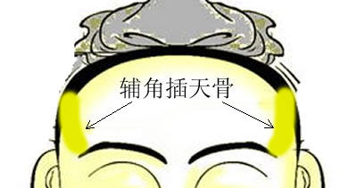 </p><p>辅角插天骨，在额角之边城部，其骨下由眉尾之三棱骨起，由福堂，过边城，上山林，入鬓曲之上，又名山林骨是也，又有上插入大脑海之百会穴止，此为清贵仙品，唐之吕纯阳祖师，即此格也，此骨长耸为上等，次则入发曲为中等，又次则近发为常品，上等辅角骨，为神仙，次圣贤，中等辅角骨，为外藩之督抚，一省执政之文武要职，下等辅角骨，为边将镇守之例，其人天性勤慎任劳，精明而专，外勇敢而内忠诚，先预谋而后进行，见嫌不避，临危如常，亲者可惑其心志，因情义之包围，智者可为其怂恿，因权利之负责，持其正义，而不计成败，守其范围，而不计安危，不移不屈也。</p><br></div>



</div>
                            <div class=