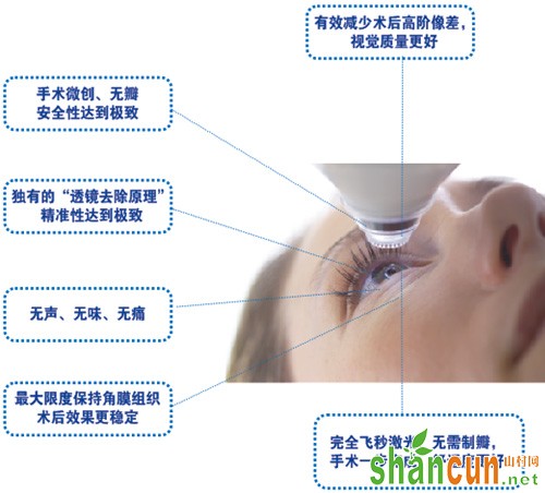 蔡司全飞秒Smile激光近视手术的优点