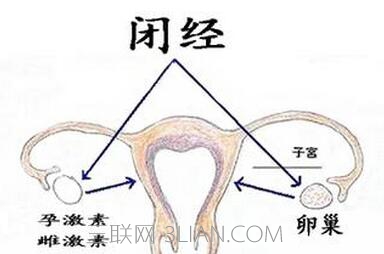 女性闭经是怎么回事      山村