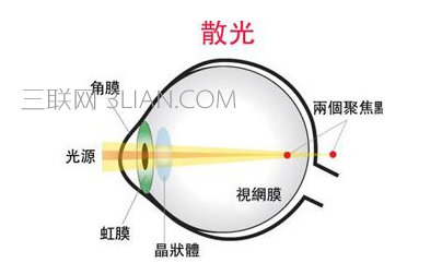 200度散光有什么症状    山村