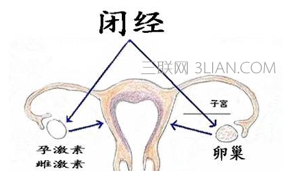 原发性闭经名词解释     山村