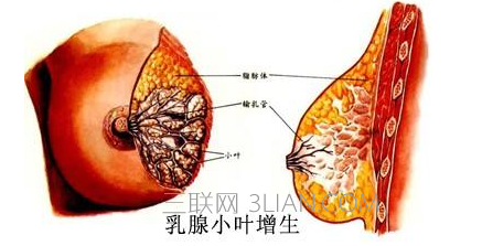 乳腺增生疼痛怎么办     山村