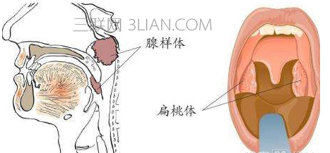扁桃体发炎什么时候会好    山村