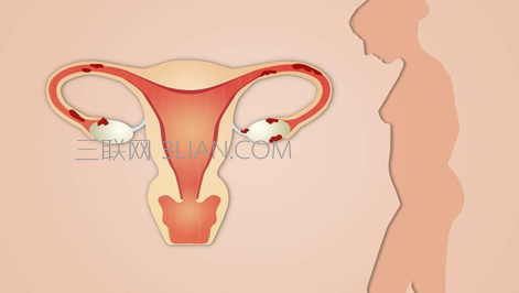 卵巢疾病有哪些症状    山村