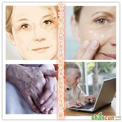 女人一般几岁开始长老年斑 如何保养肌肤预防老年斑 山村