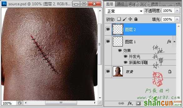 Photoshop合成人物缝合的伤口效果教程,PS教程,素材中国