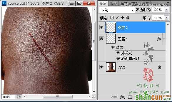 Photoshop合成人物缝合的伤口效果教程,PS教程,素材中国
