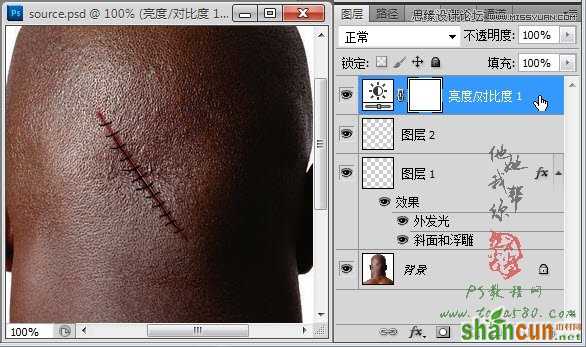Photoshop合成人物缝合的伤口效果教程,PS教程,素材中国