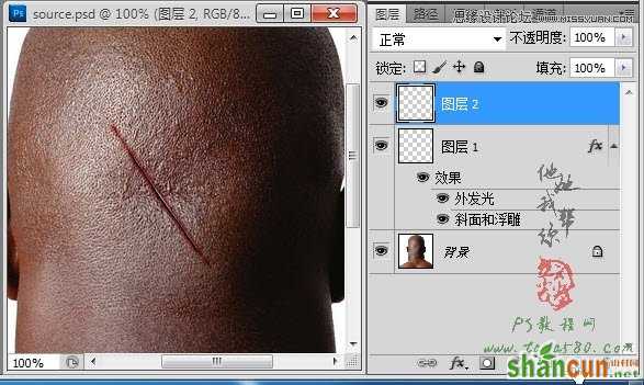 Photoshop合成人物缝合的伤口效果教程,PS教程,素材中国