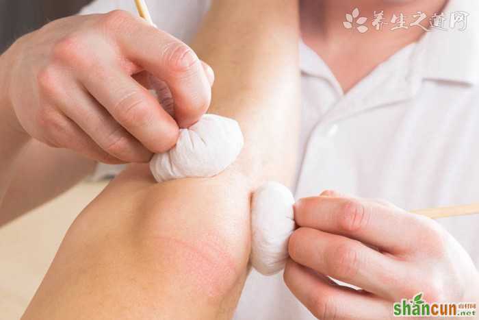 近视眼激光手术过程